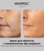 MEDIPEEL Peptide 9 Volume & Tension Tox Cream Pro