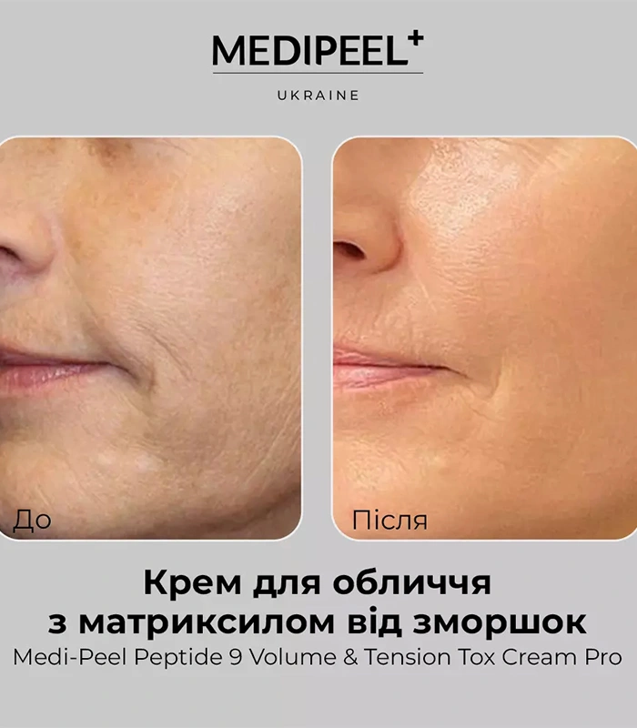 MEDIPEEL Peptide 9 Volume & Tension Tox Cream Pro